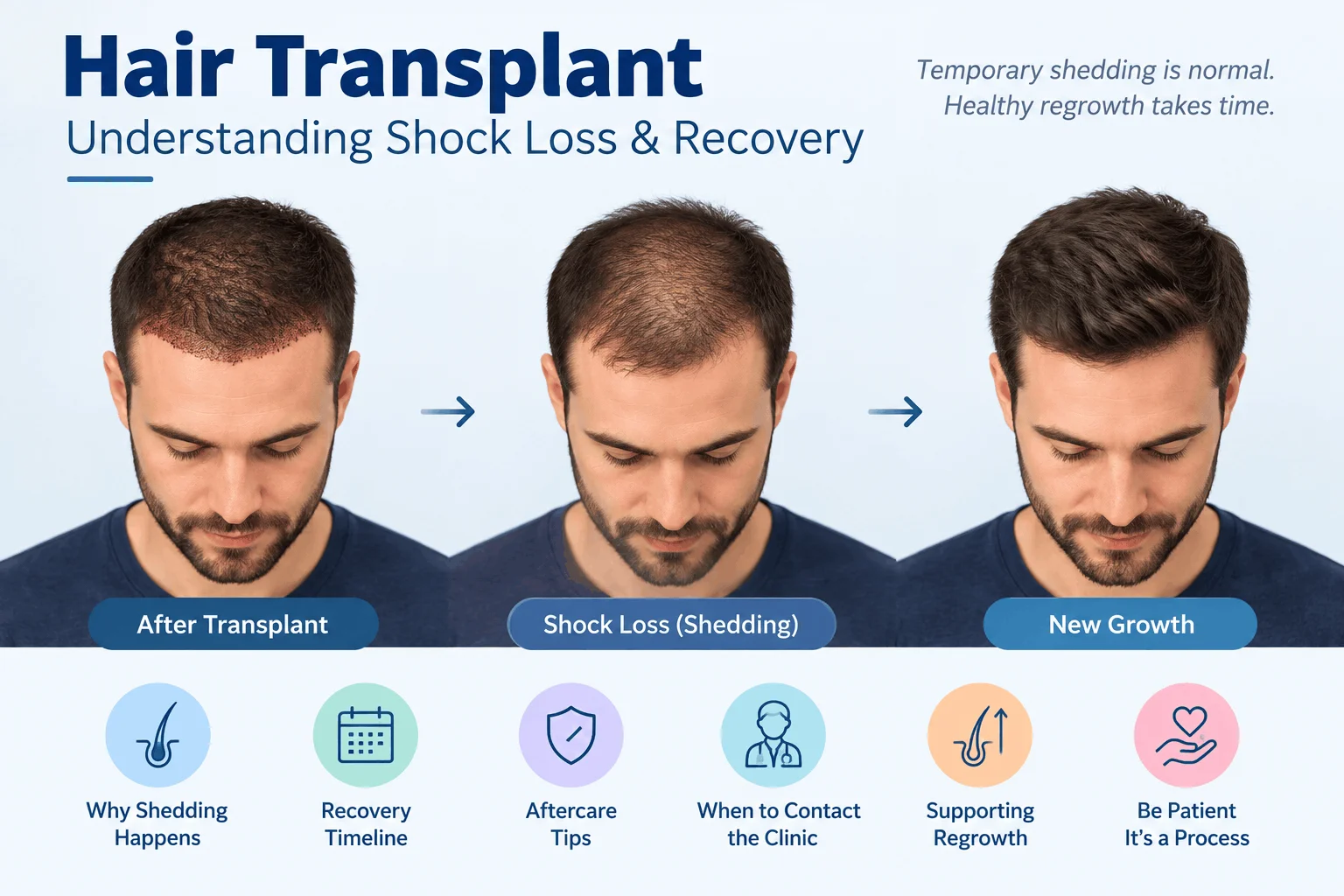 Hair Transplant